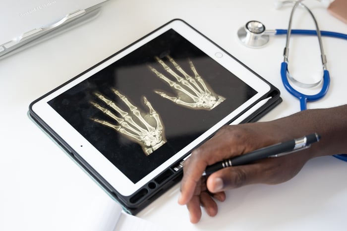 x-ray on tablet and hand with pen